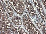 SLA2 Antibody in Immunohistochemistry (Paraffin) (IHC (P))