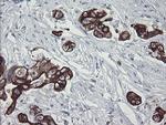 SLA2 Antibody in Immunohistochemistry (Paraffin) (IHC (P))