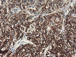 SLA2 Antibody in Immunohistochemistry (Paraffin) (IHC (P))