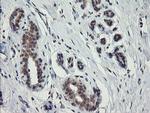 SLA2 Antibody in Immunohistochemistry (Paraffin) (IHC (P))