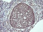 SLA2 Antibody in Immunohistochemistry (Paraffin) (IHC (P))