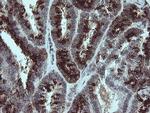 SLA2 Antibody in Immunohistochemistry (Paraffin) (IHC (P))