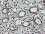 SLA2 Antibody in Immunohistochemistry (Paraffin) (IHC (P))