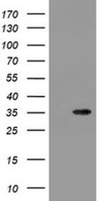 SLA2 Antibody in Western Blot (WB)