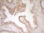 SLAMF7 Antibody in Immunohistochemistry (Paraffin) (IHC (P))