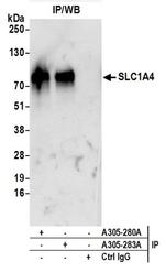 SLC1A4/ASCT1 Antibody in Western Blot (WB)