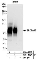 SLC6A15 Antibody in Western Blot (WB)