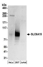 SLC6A15 Antibody in Western Blot (WB)