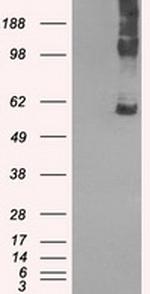 SLC7A8 Antibody in Western Blot (WB)