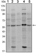 SMAD4 Antibody in Western Blot (WB)