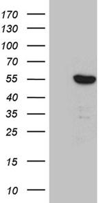 SMARCD3 Antibody in Western Blot (WB)