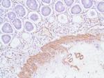 Alpha-Smooth Muscle Actin Antibody in Immunohistochemistry (IHC)