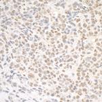 SMC1 Antibody in Immunohistochemistry (IHC)