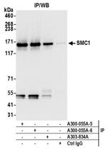 SMC1 Antibody in Western Blot (WB)