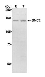 SMC2 Antibody in Western Blot (WB)