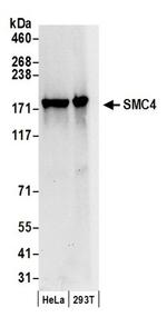 SMC4 Antibody in Western Blot (WB)