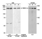 SMC4 Antibody in Western Blot (WB)