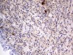 SMPD1 Antibody in Immunohistochemistry (Paraffin) (IHC (P))