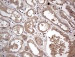 SMPD1 Antibody in Immunohistochemistry (Paraffin) (IHC (P))