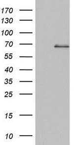 SMPD1 Antibody in Western Blot (WB)