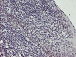 SNAI2 Antibody in Immunohistochemistry (Paraffin) (IHC (P))