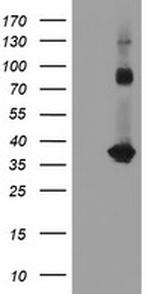 SNAI2 Antibody in Western Blot (WB)