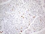 SNRPB2 Antibody in Immunohistochemistry (Paraffin) (IHC (P))