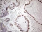 SNRPB2 Antibody in Immunohistochemistry (Paraffin) (IHC (P))