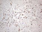 SNRPB2 Antibody in Immunohistochemistry (Paraffin) (IHC (P))