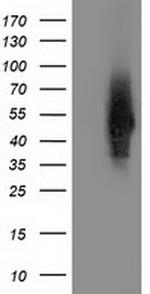 SNTA1 Antibody in Western Blot (WB)