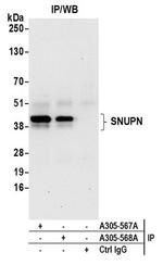 SNUPN Antibody in Western Blot (WB)
