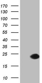 SNX12 Antibody in Western Blot (WB)