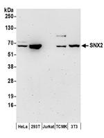 SNX2 Antibody in Western Blot (WB)