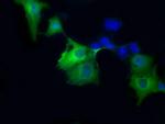 SORD Antibody in Immunocytochemistry (ICC/IF)