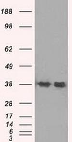 SORD Antibody in Western Blot (WB)