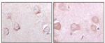 SORL1 Antibody in Immunohistochemistry (Paraffin) (IHC (P))