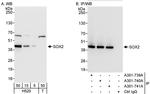 SOX2 Antibody in Western Blot (WB)