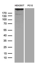 SPAG5 Antibody in Western Blot (WB)