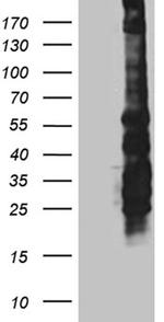 SPAG5 Antibody in Western Blot (WB)