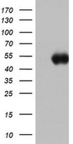 SPATA2L Antibody in Western Blot (WB)