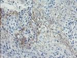 SPINT1 Antibody in Immunohistochemistry (Paraffin) (IHC (P))