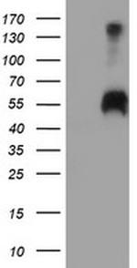 SPINT1 Antibody in Western Blot (WB)