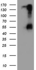 SPINT1 Antibody in Western Blot (WB)