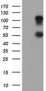 SPINT1 Antibody in Western Blot (WB)