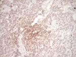 SPP1 Antibody in Immunohistochemistry (Paraffin) (IHC (P))