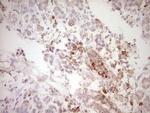 SPP1 Antibody in Immunohistochemistry (Paraffin) (IHC (P))