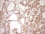 SPP1 Antibody in Immunohistochemistry (Paraffin) (IHC (P))