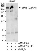 SPTBN2/SCA5 Antibody in Immunoprecipitation (IP)