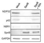 SQSTM1 Antibody in Western Blot (WB)