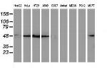 SQSTM1 Antibody in Western Blot (WB)